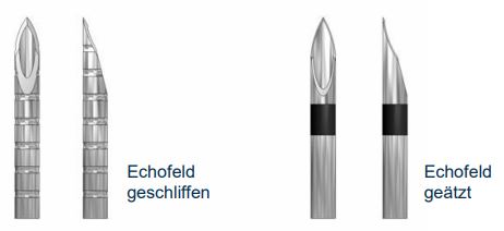 Echofelder Vergleich